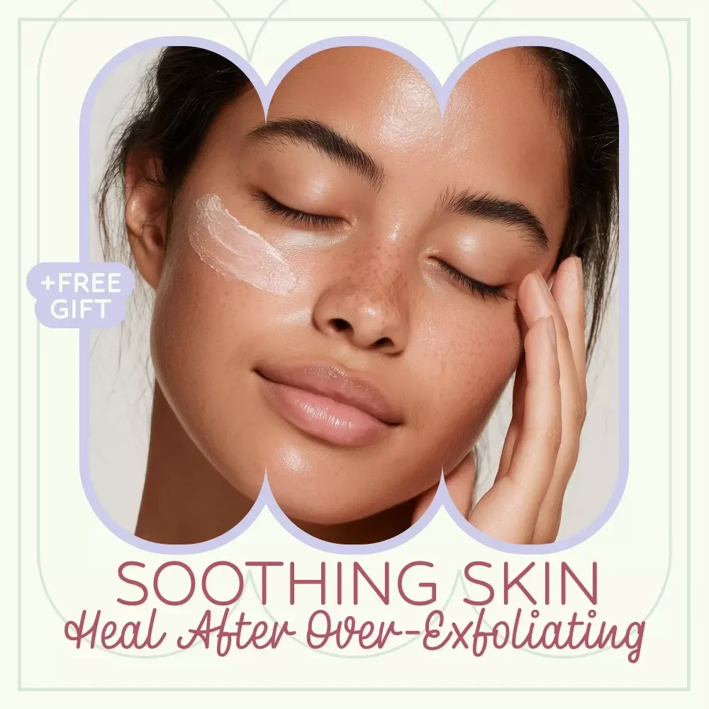 Soothing Skin: Heal After Over-Exfoliating | Skin Barrier Repair After Over Exfoliating Checklist | Gentle Skincare Recovery Guide Digital Download