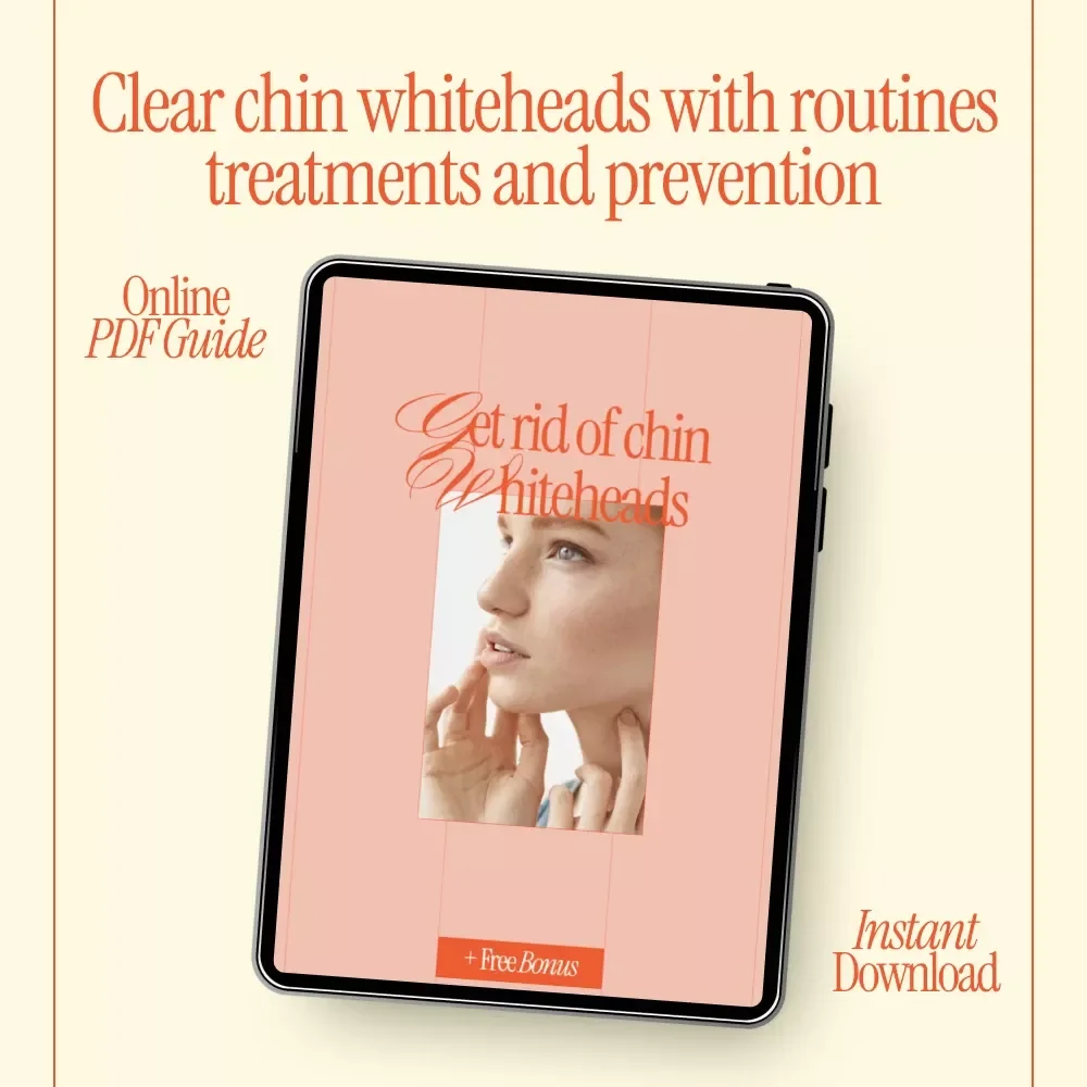 Get Rid of Chin Whiteheads – Clear Skin Routine, Targeted Treatments & Prevention