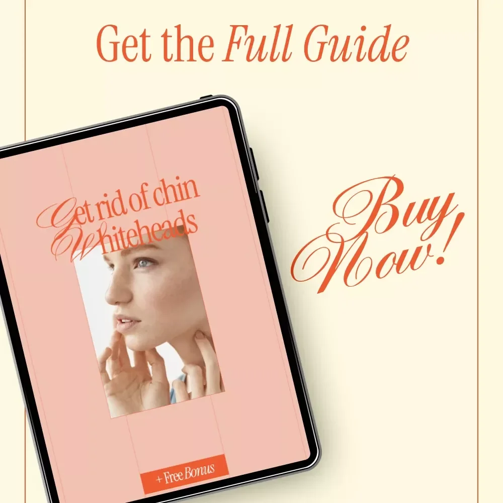 Get Rid of Chin Whiteheads – Clear Skin Routine, Targeted Treatments & Prevention
