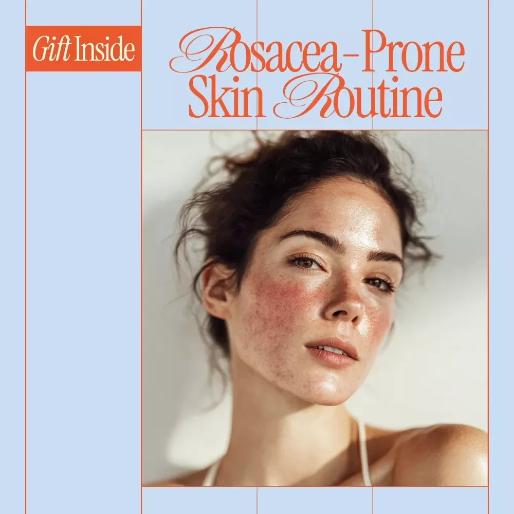 Skincare for Rosacea-Prone Skin Guide | Complete Skincare for Rosacea Prone Skin Routine, Triggers, Lifestyle Tips & Smart Tools