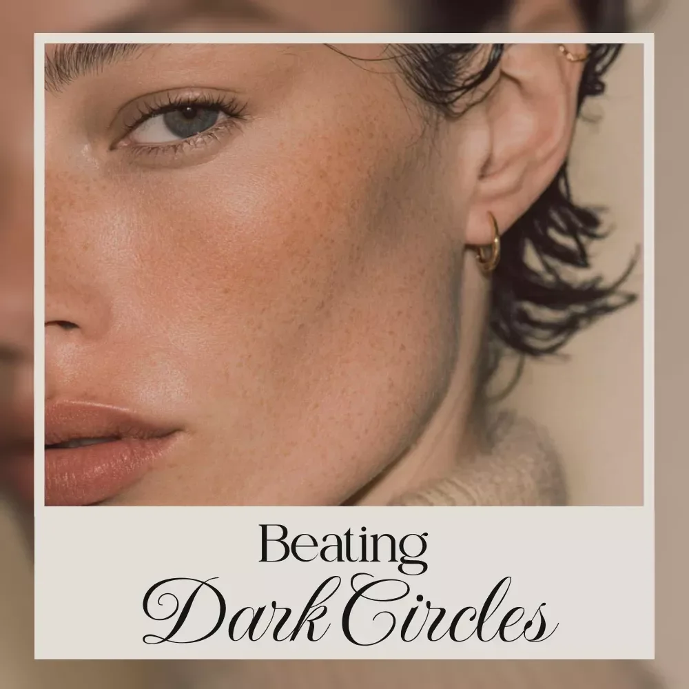 The Guide to Beating Dark Circles | Digital Skincare Guide for Brighter Eyes, Treatments, Daily Habits & Smart Solutions