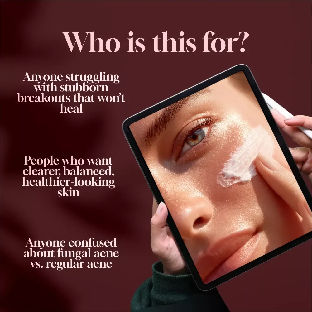 Fungal Acne Or Not? Clear-Skin Checklist | Digital Download Skincare Guide for Identifying, Managing & Treating Fungal Acne Naturally