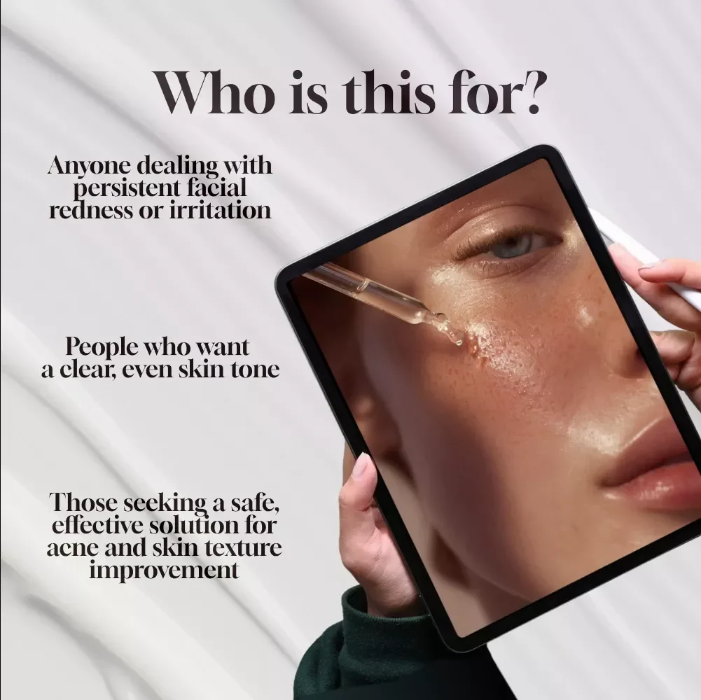 Azelaic Acid Routine for Redness Relief - Complete Guide for Acne, Skin Texture, and Redness Control