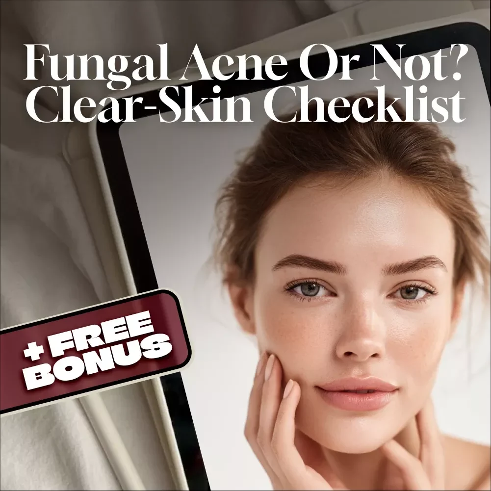 Fungal Acne Or Not? Clear-Skin Checklist | Digital Download Skincare Guide for Identifying, Managing & Treating Fungal Acne Naturally
